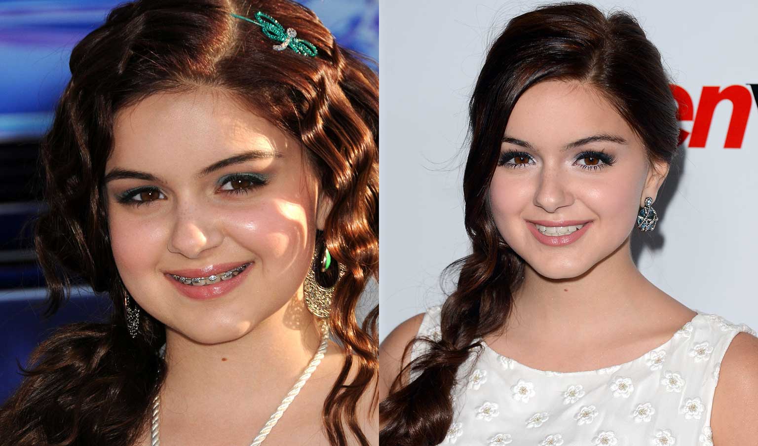 Ariel Winter before and after braces